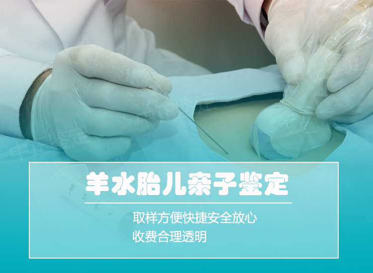 金华羊水孕期亲子鉴定